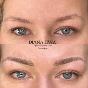 Hvas - Perfecting Beauty